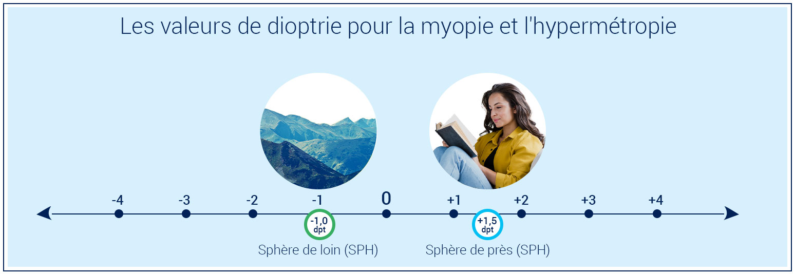 dioptre values for myopia and hyperopia