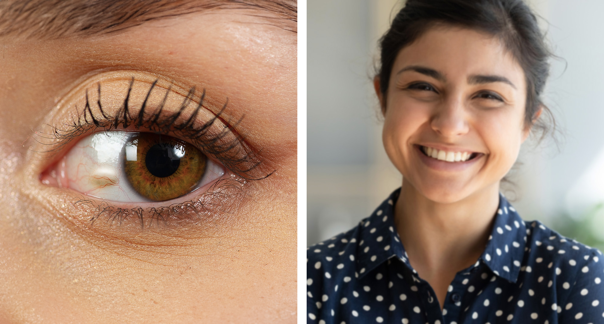 Les dommages causés par le soleil aux yeux : Risques et prévention ...